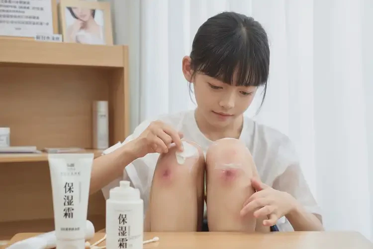 青少年大腿上偶爾起濕疹能徹底自愈嗎(圖3)