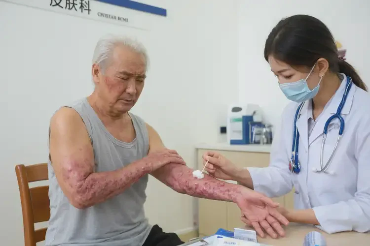 老人屁股出濕疹能靠自己自愈嗎(圖3)