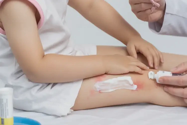 少兒屁股偶爾起濕疹可以徹底自愈嗎(圖3)