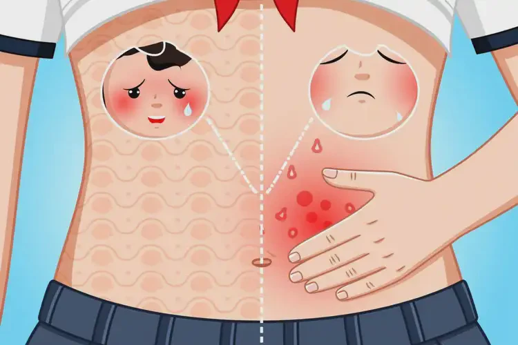 大學(xué)生肚子偶爾起濕疹不管它會自己好嗎(圖2)