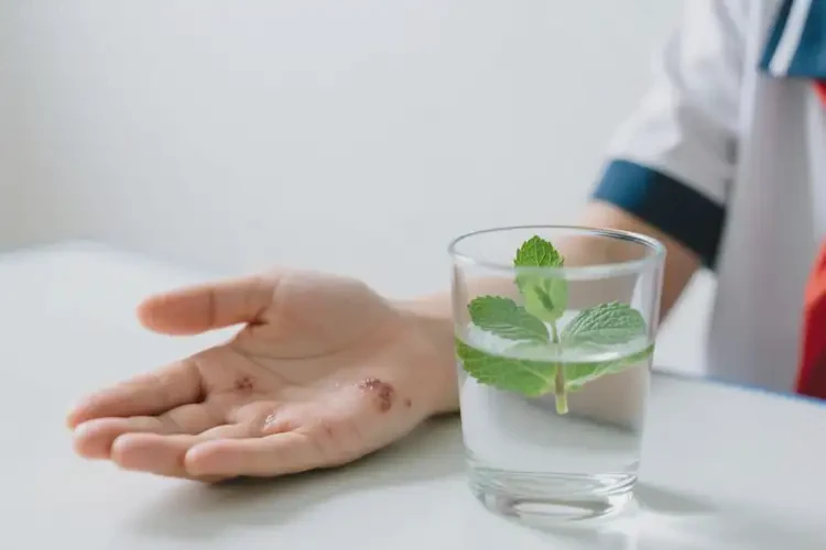 中學(xué)生手上出現(xiàn)濕疹可以徹底自愈嗎(圖3)