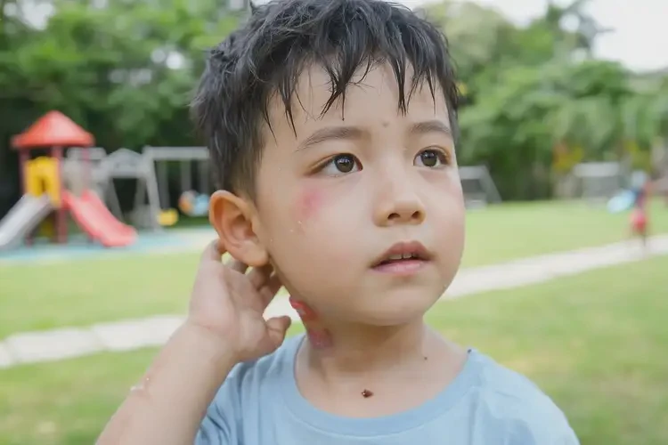 小孩脖子偶爾長(zhǎng)濕疹不管它會(huì)自己痊愈嗎(圖4)