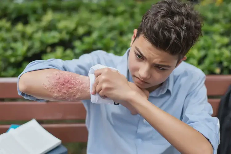 大學(xué)生手臂上偶爾起濕疹不管它會(huì)自己自愈嗎(圖4)