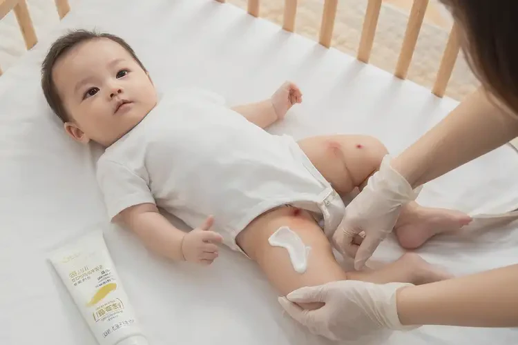 寶寶大腿容易長(zhǎng)濕疹不管它會(huì)自己痊愈嗎(圖3)