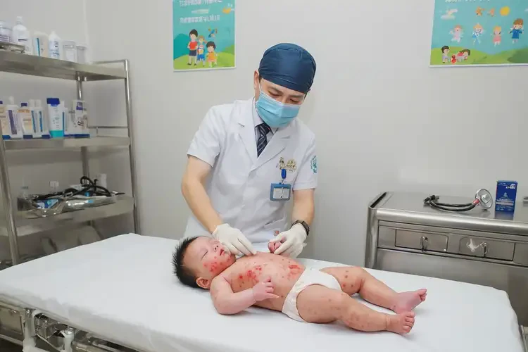 嬰兒全身長濕疹能徹底自愈嗎(圖3)