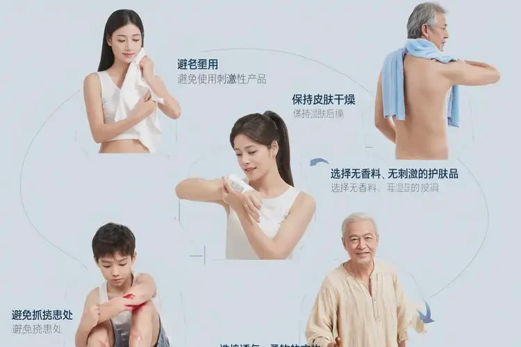 男人脖子偶爾長濕疹不管它會自己好嗎(圖2)