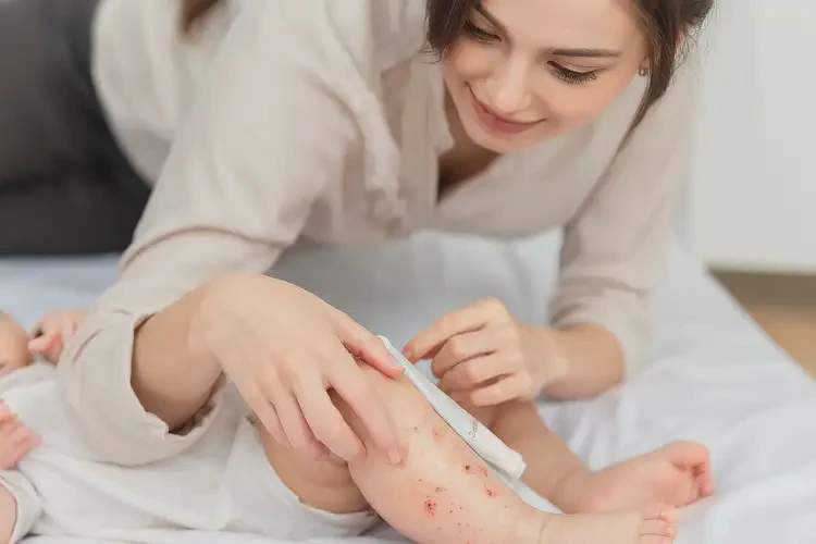 寶寶大腿上長濕疹能靠自己自愈嗎(圖1)