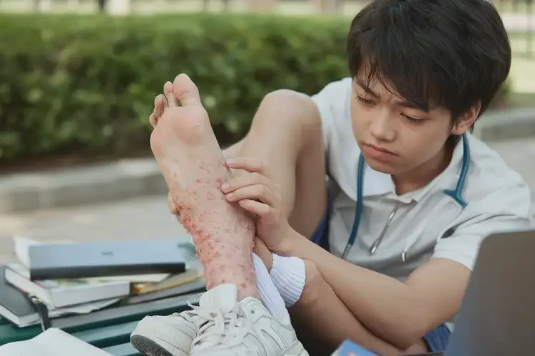 大學(xué)生腳上偶爾起濕疹能徹底自愈嗎(圖4)