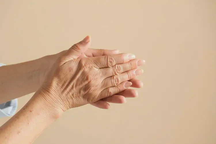 高龄老人手上偶尔长湿疹能彻底自愈吗(图4)