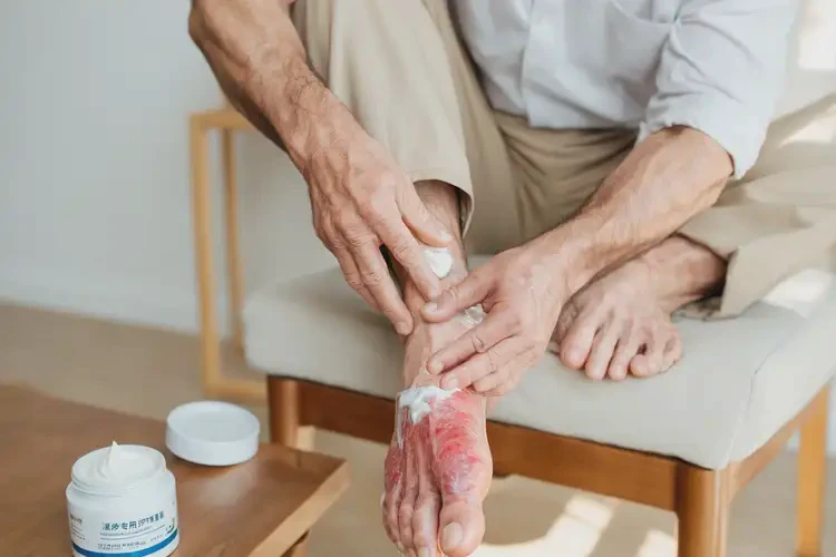 男生脚上经常长湿疹能彻底自愈吗(图2)