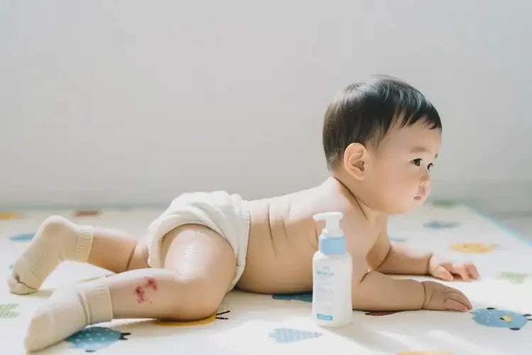 幼兒大腿上出現(xiàn)濕疹不管它會自己好嗎(圖3)