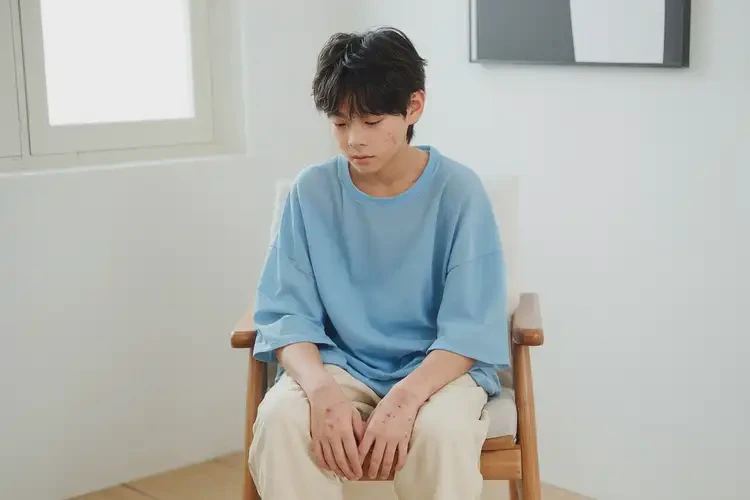 青少年大腿容易長濕疹可以徹底自愈嗎(圖1)