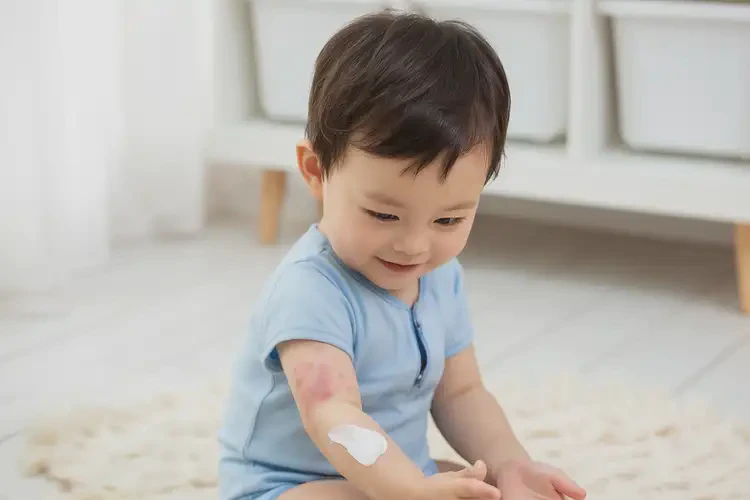 幼兒手臂上偶爾起濕疹能不能徹底自愈(圖3)