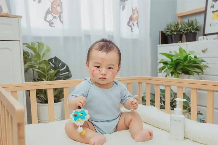 嬰兒臉上起濕疹可以徹底自愈嗎(圖1)