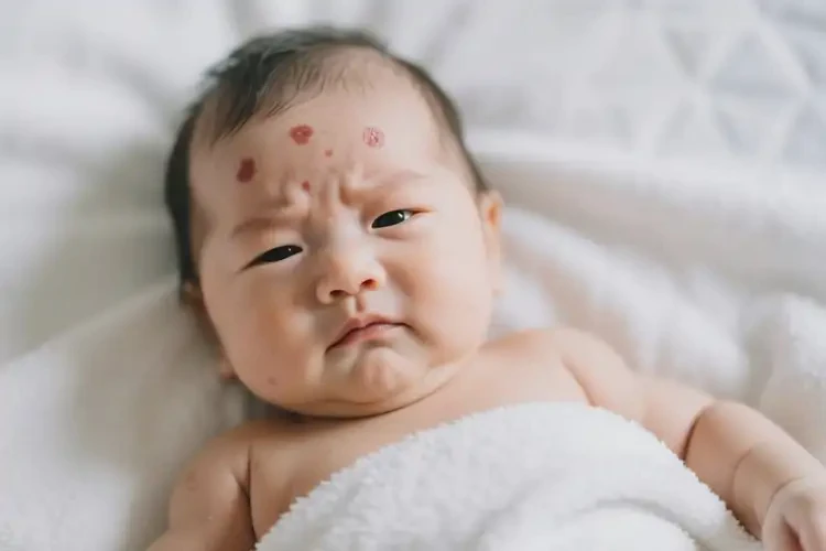 嬰兒面部偶爾起濕疹不管它會自己自愈嗎(圖3)