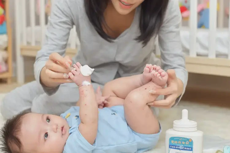 嬰兒腳上經(jīng)常長濕疹能靠自己自愈嗎(圖3)