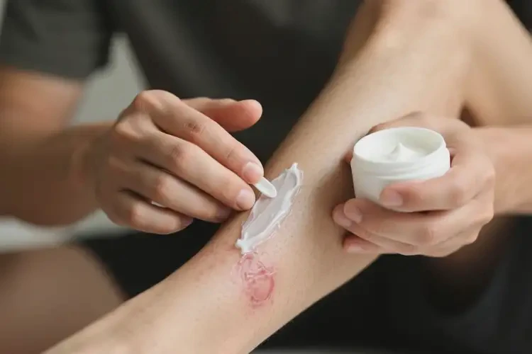 男人小腿經(jīng)常長(zhǎng)濕疹能夠徹底治愈嗎(圖1)