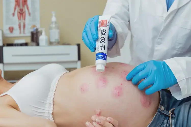 孕婦屁股上經(jīng)常長(zhǎng)濕疹不管它會(huì)自己好嗎(圖2)