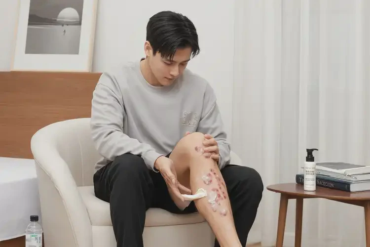 青年人小腿容易長(zhǎng)濕疹不管它會(huì)自己自愈嗎(圖2)