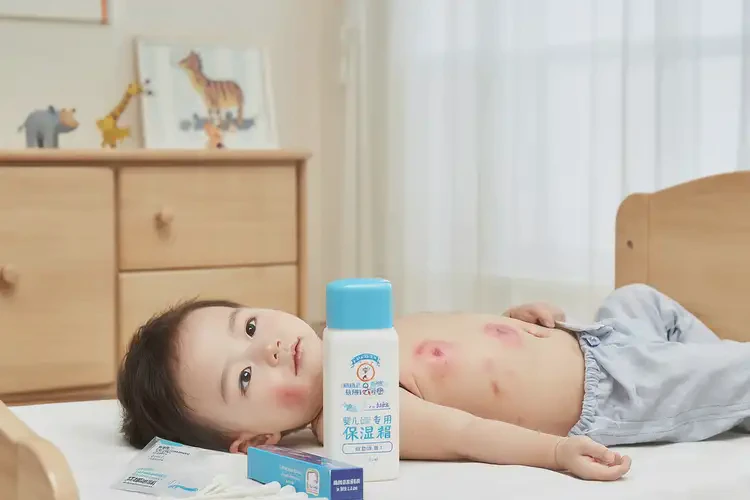 儿童肚子容易长湿疹能靠自己自愈吗(图3)