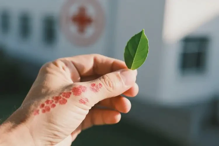 男性全身經(jīng)常起濕疹能夠徹底治愈嗎(圖4)