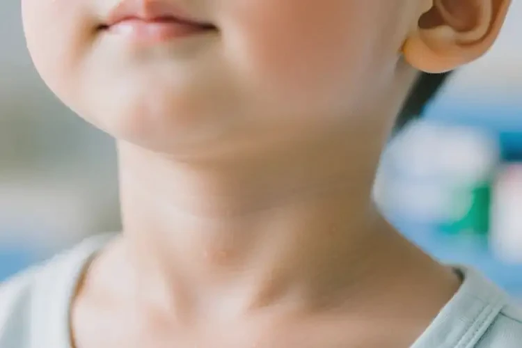 小孩脖子上經(jīng)常起濕疹可以徹底自愈嗎(圖1)