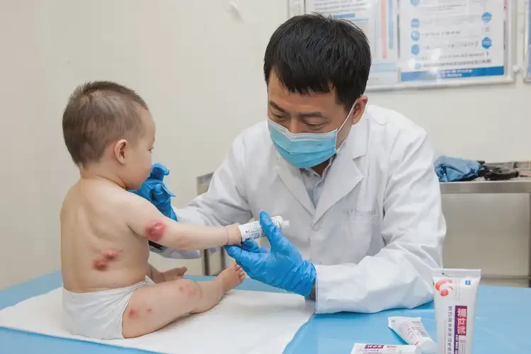 嬰幼兒面部出濕疹不管它會自己痊愈嗎(圖3)