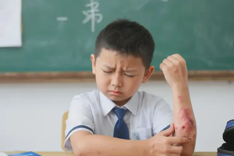 小學生四肢經(jīng)常起濕疹可以徹底自愈嗎(圖4)