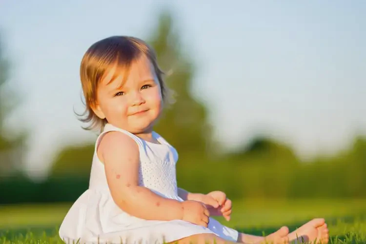 小孩身上偶爾起濕疹可不可以徹底自愈(圖4)