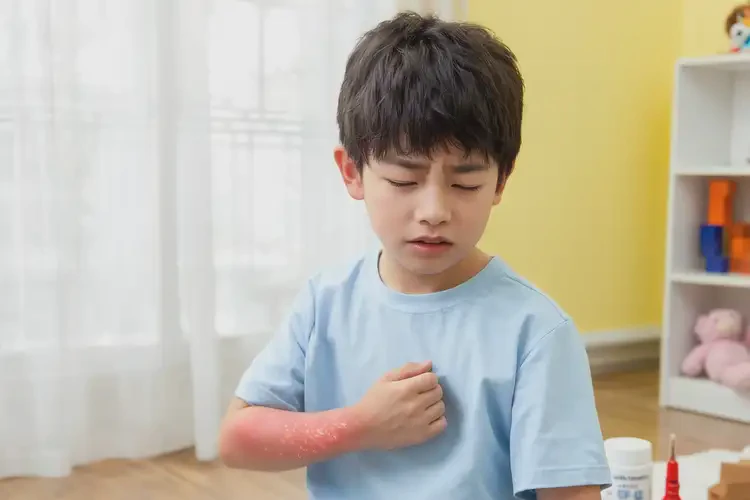 孩子四肢偶爾長(zhǎng)濕疹可不可以徹底自愈(圖4)