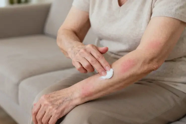 老年人手臂出現(xiàn)濕疹能徹底自愈嗎(圖2)