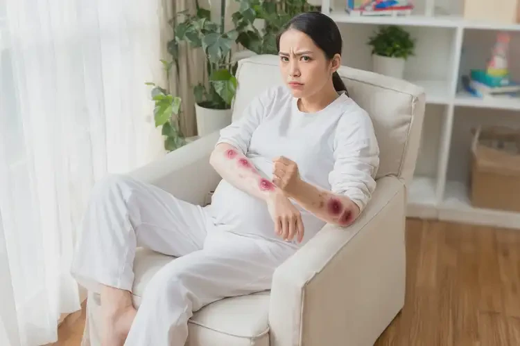 孕妇手上偶尔起湿疹可以彻底自愈吗(图3)