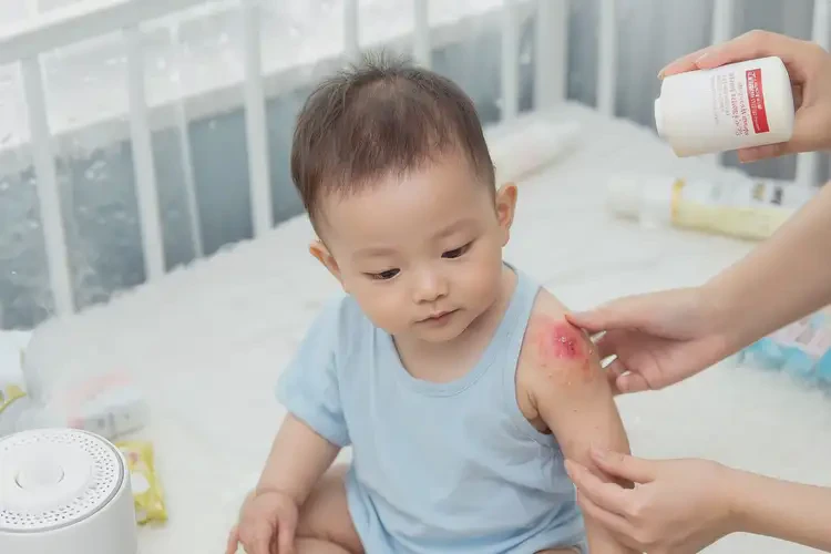 嬰兒手臂容易長濕疹可以徹底自愈嗎(圖1)