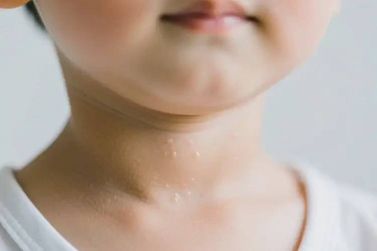 小孩脖子上經(jīng)常起濕疹可以徹底自愈嗎(圖2)