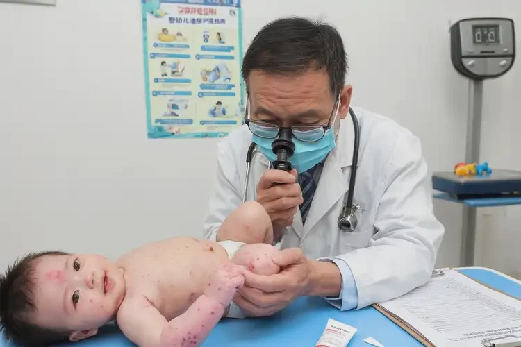 婴儿屁股出湿疹能靠自己自愈吗(图1)