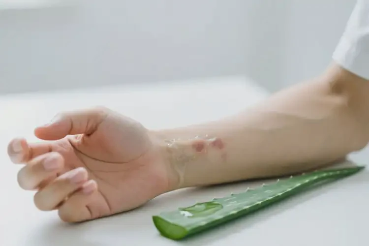 男生手臂容易長濕疹能靠自己自愈嗎(圖2)