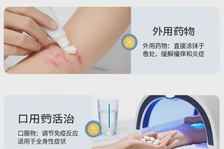 女人屁股上有濕疹能不能徹底自愈(圖1)