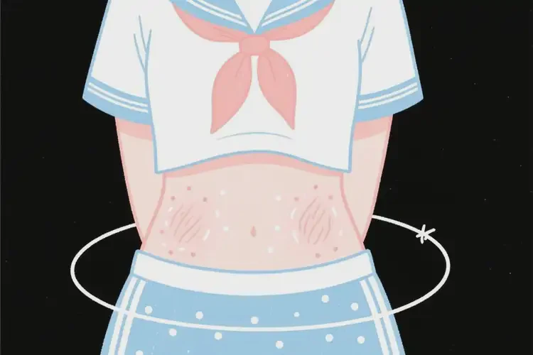 中學(xué)生肛周出濕疹能徹底自愈嗎(圖1)