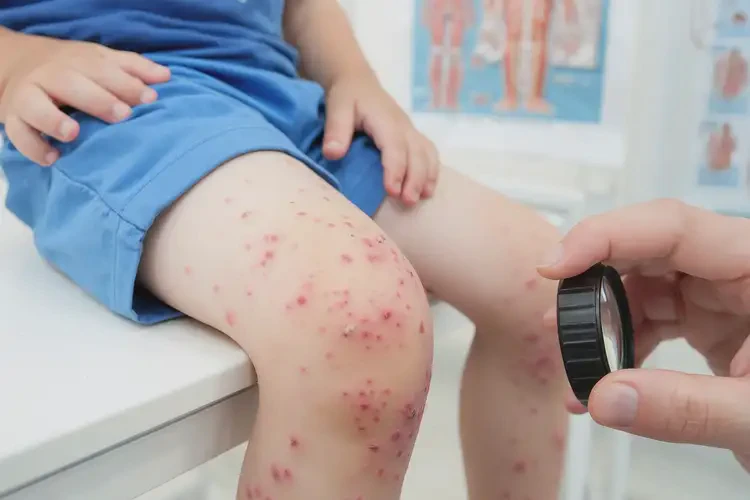 小孩大腿上出濕疹能夠徹底治愈嗎(圖4)