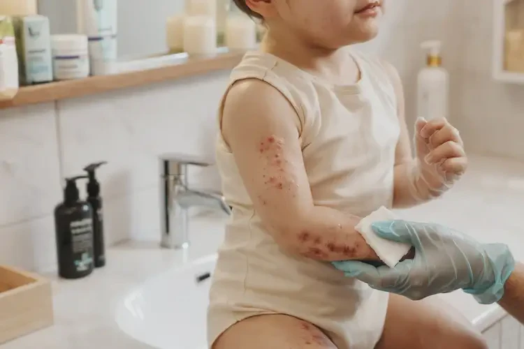 少兒脖子上容易起濕疹可不可以徹底自愈(圖1)