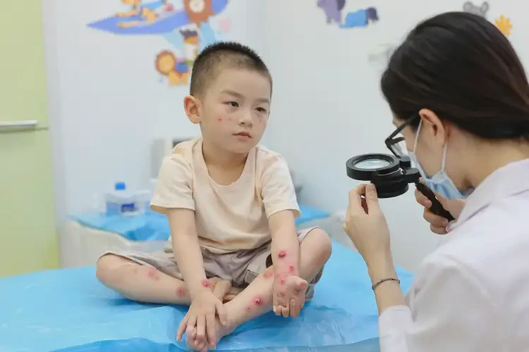 孩子全身偶爾起濕疹不管它會自己自愈嗎(圖4)