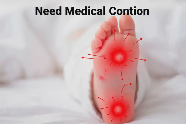 婴儿脚上偶尔起湿疹不管它会自己好吗(图2)