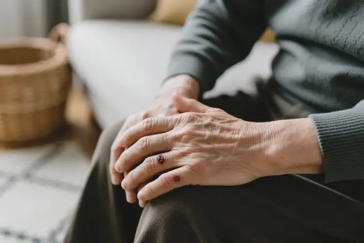 老年人四肢偶爾長濕疹能夠徹底治愈嗎(圖2)