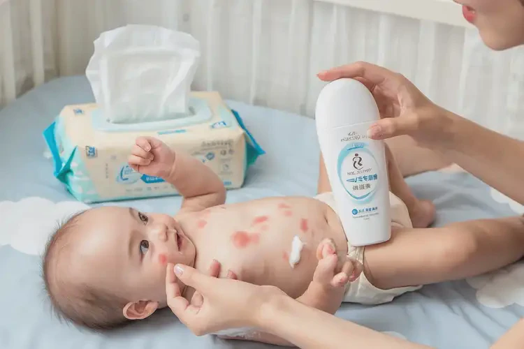 嬰兒全身長濕疹能徹底自愈嗎(圖4)