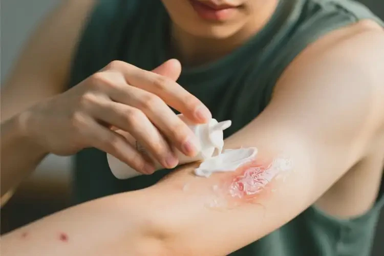 青年人手臂容易長(zhǎng)濕疹可以徹底自愈嗎(圖1)