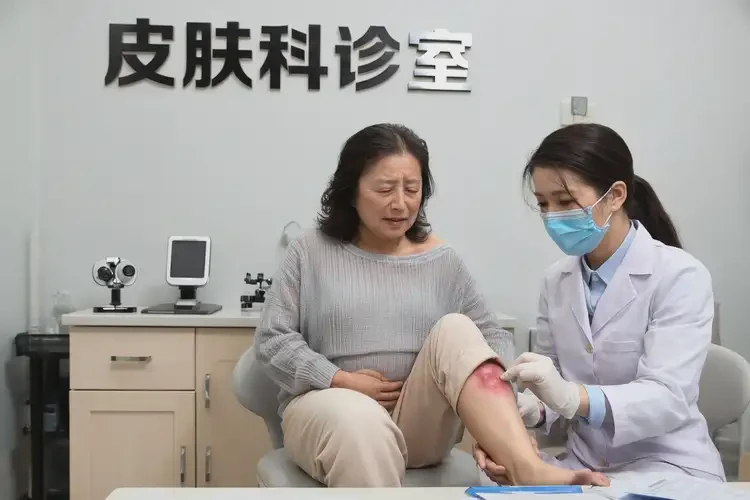 孕婦小腿上容易長(zhǎng)濕疹能靠自己自愈嗎(圖2)