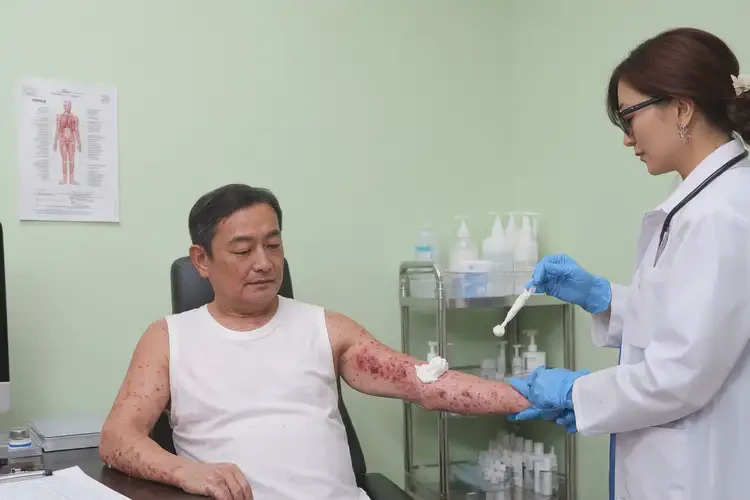 男性全身容易長濕疹能靠自己自愈嗎(圖3)