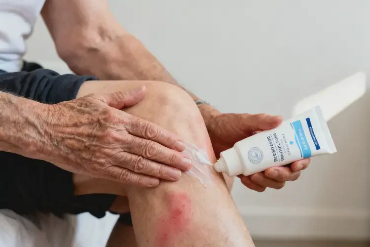 老人大腿偶爾起濕疹不管它會自己自愈嗎(圖2)