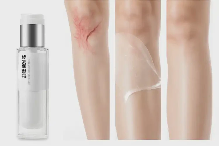 女性小腿長濕疹不管它會(huì)自己自愈嗎(圖3)