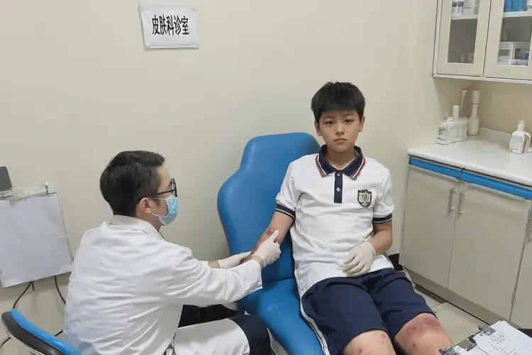 中學生全身長濕疹能夠徹底治愈嗎(圖4)